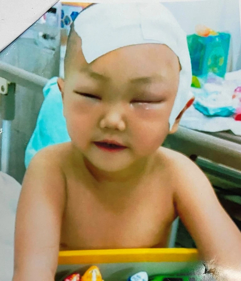 Giúp đỡ cháu bé bị ung thư não